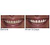 Supersmile The Works + Whitening PreRinse, 2 of 5