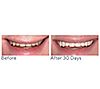 Supersmile The Works + Whitening PreRinse, 3 of 5