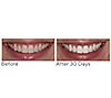 Supersmile The Works + Whitening PreRinse, 4 of 5