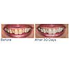Supersmile The Works + Whitening PreRinse, 5 of 5