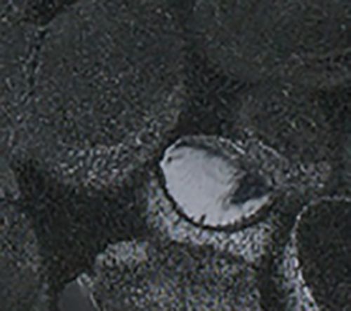 Black Circles