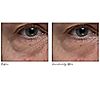 ELEMIS Ultra Smart Pro-Collagen Eye Treatment Duo, 3 of 6