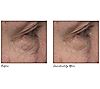 ELEMIS Ultra Smart Pro-Collagen Eye Treatment Duo, 4 of 6