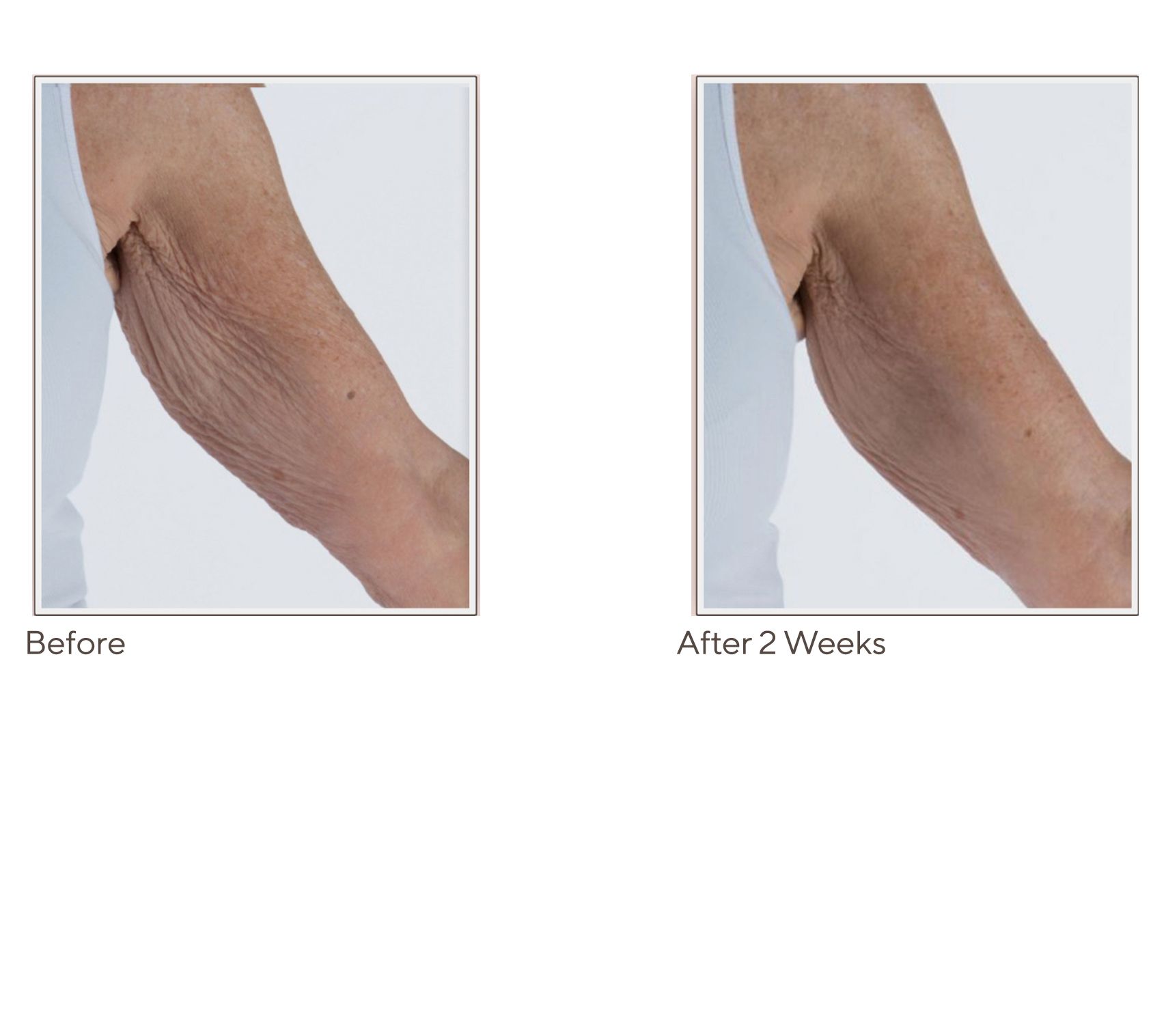 Crepe Erase Review  Does It Really Work? My 4-Week Transformation 