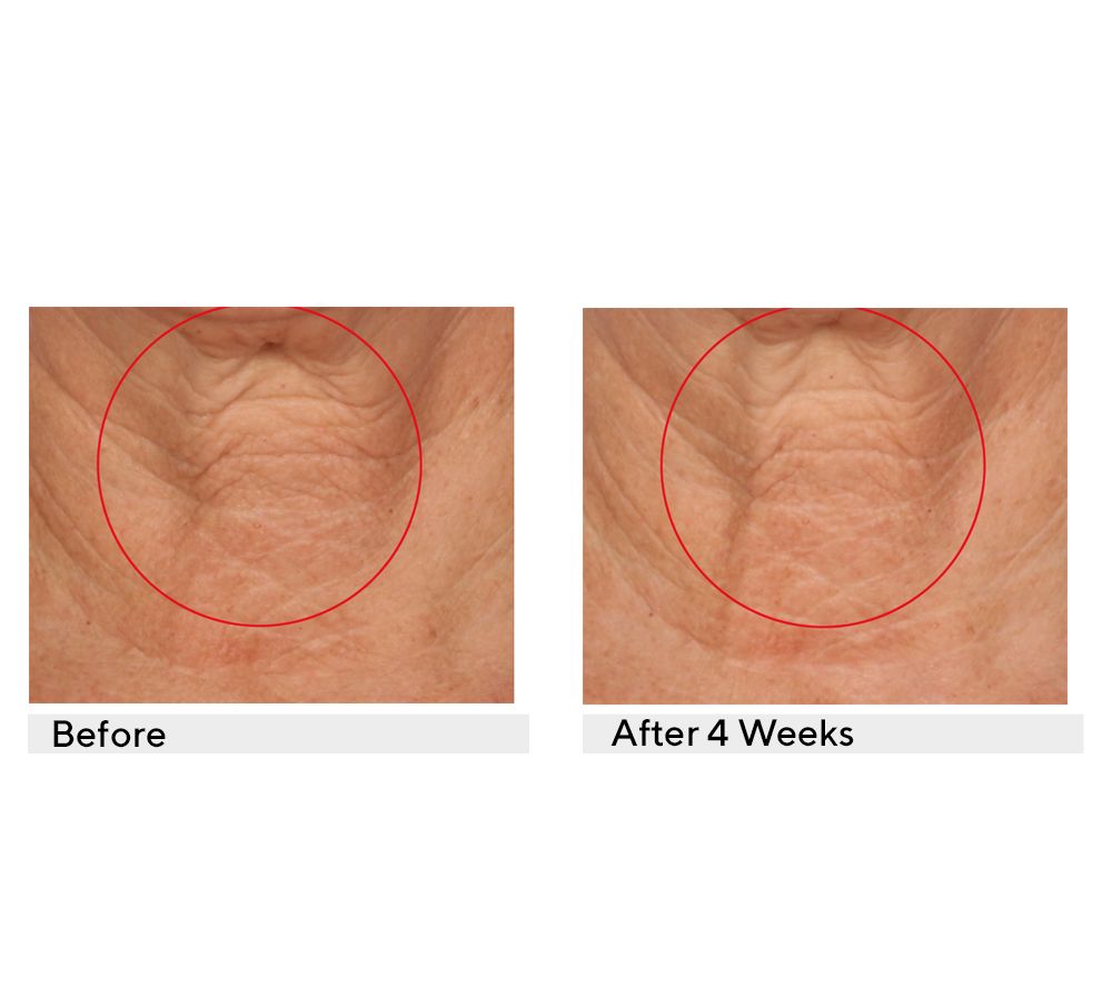 SERIOUS SKINCARE Reverse Lift Correc-Chin In-Tense Cream