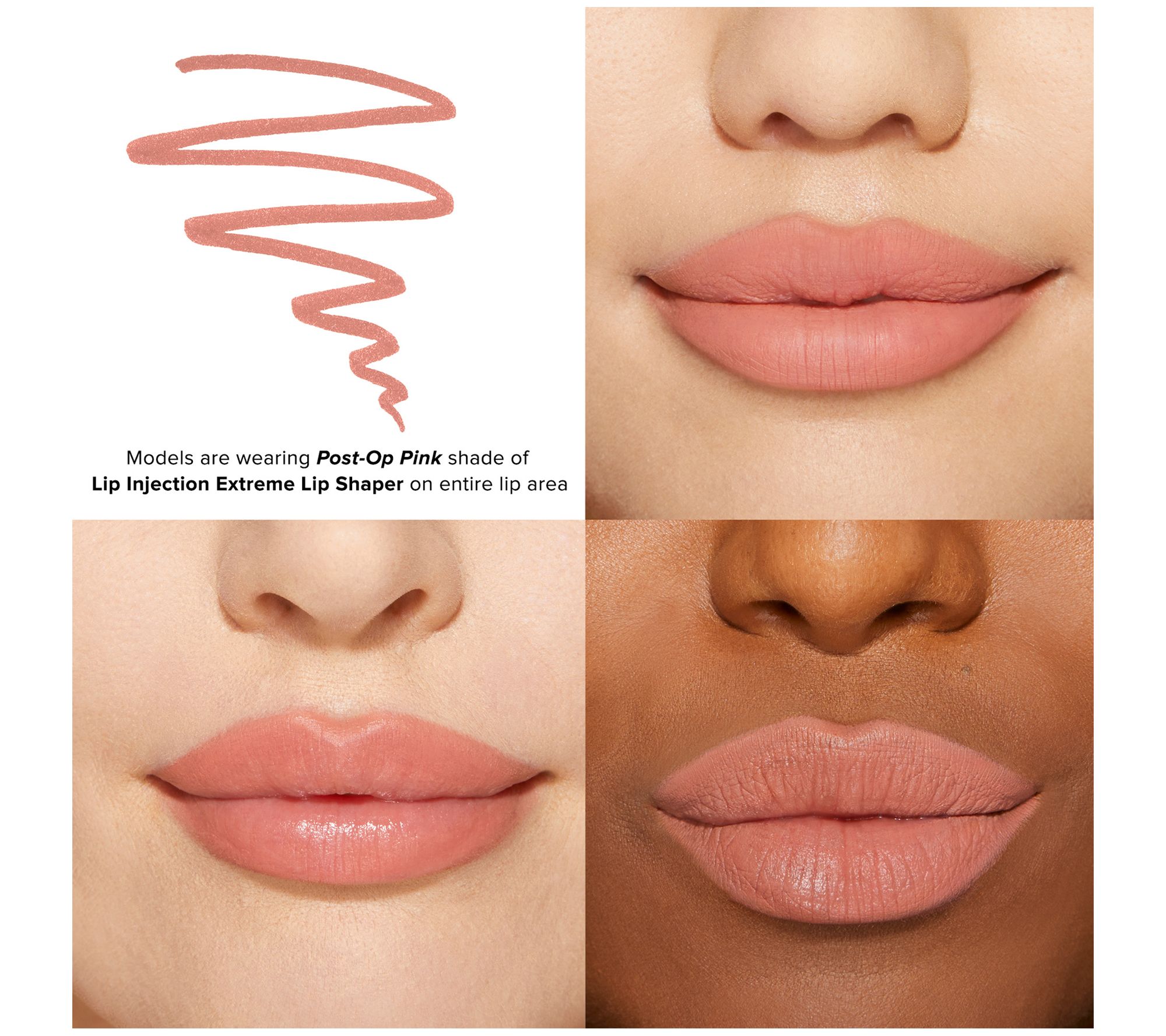 too faced lip injection before after