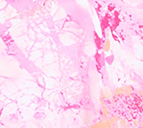 Berry Collage