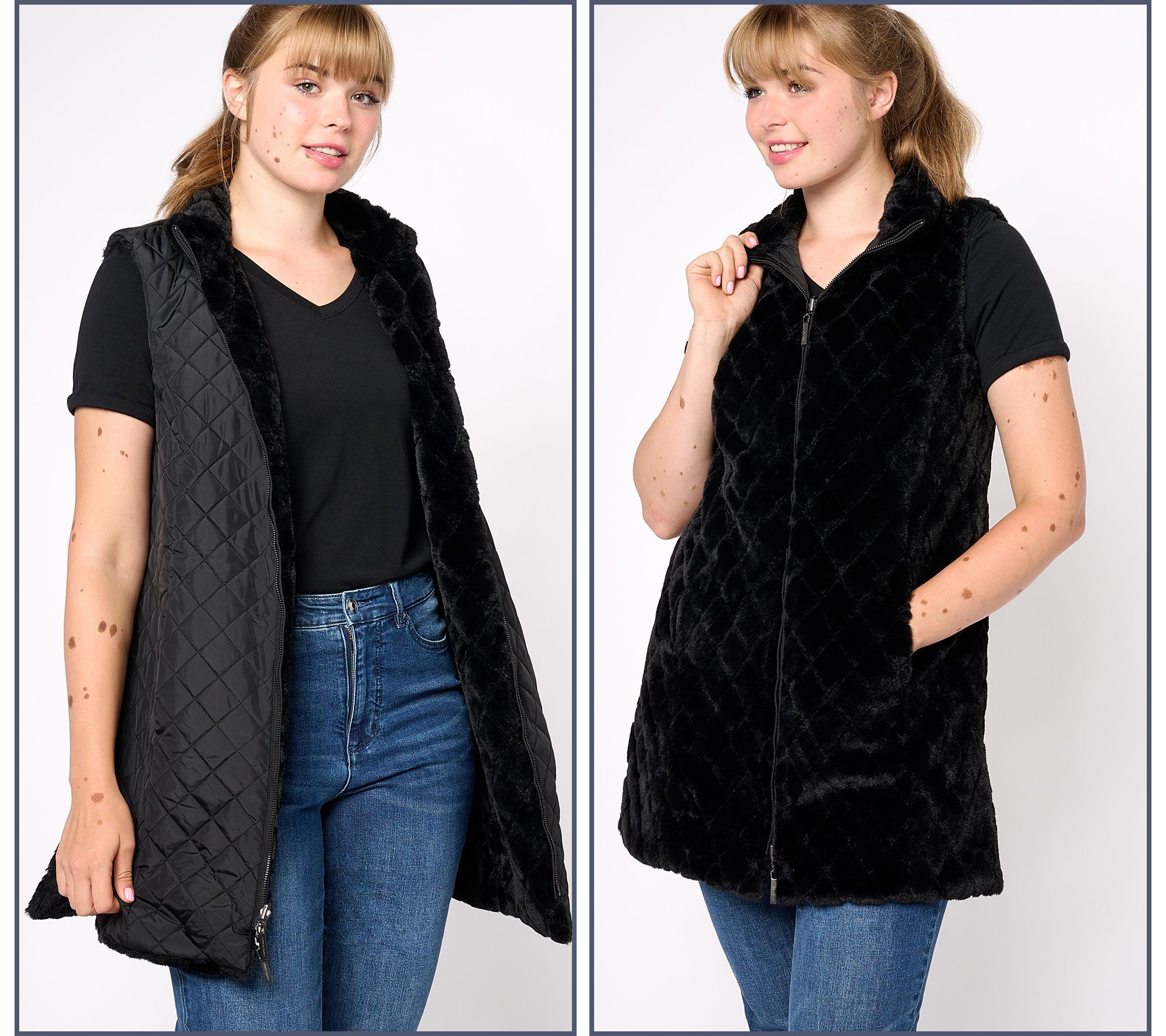 Dennis Basso Zip Front Faux Fur Reversible Vest w/ Side Slits