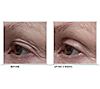 ELEMIS Peptide4 Eye Recovery Cream Trio, 4 of 5