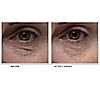 ELEMIS Peptide4 Eye Recovery Cream Trio, 5 of 5