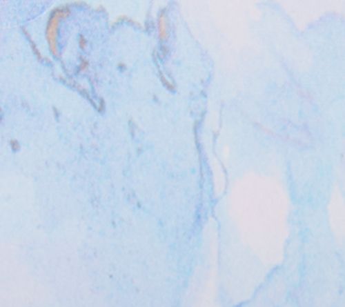 Blue Marble