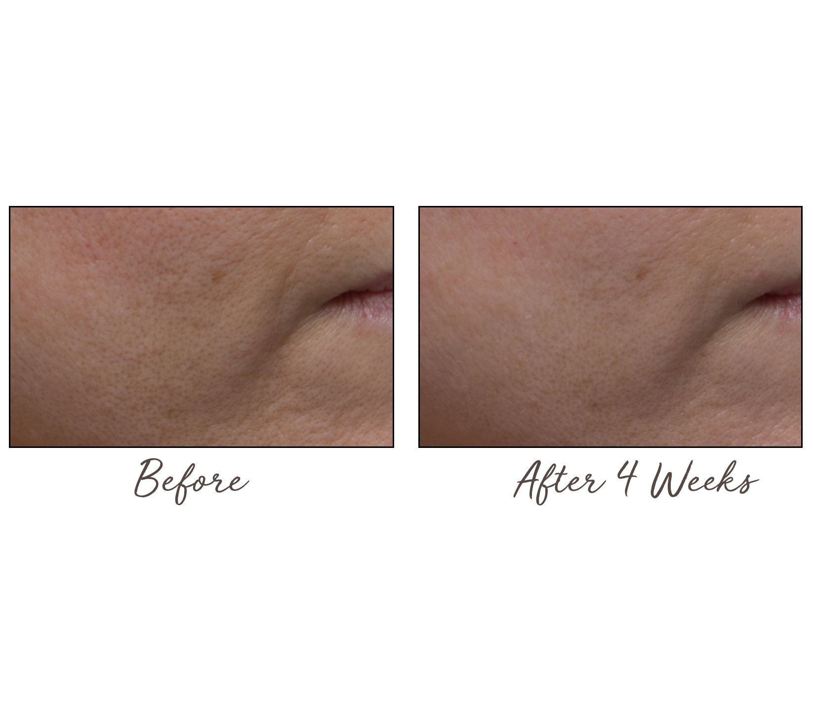 (QVC) Lancer The Method Polish, Cleanse & Nourish 3Piece Kit