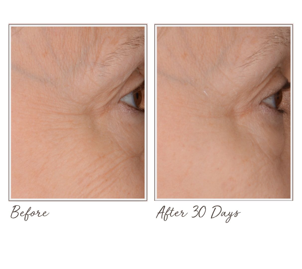 (QVC) BeautyBio GloPRO Facial Tool With Eye Roller, Prep Pads & Case