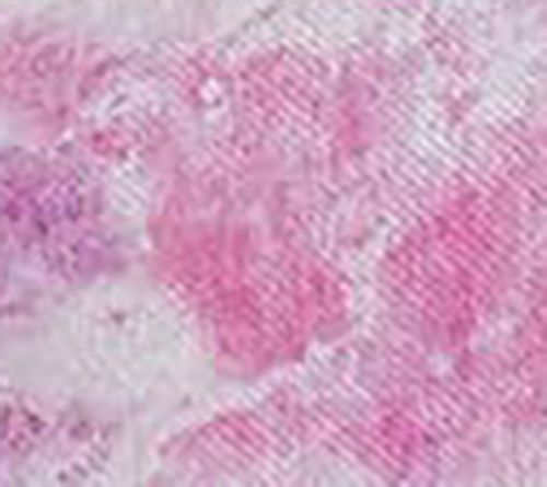 Tie Dye Pink