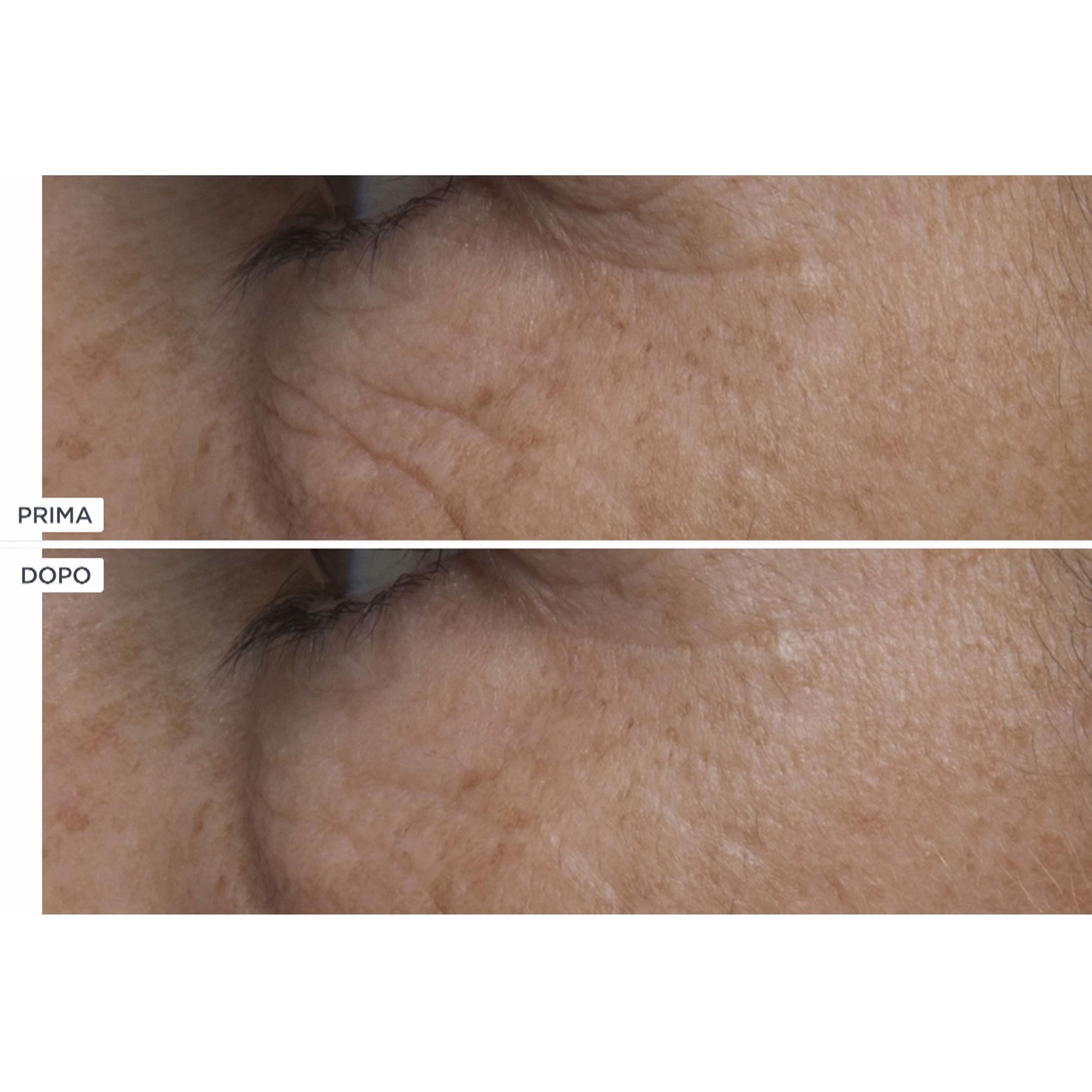 Image of Perricone MD Trattamento contorno occhi + No Make Up Mascara061