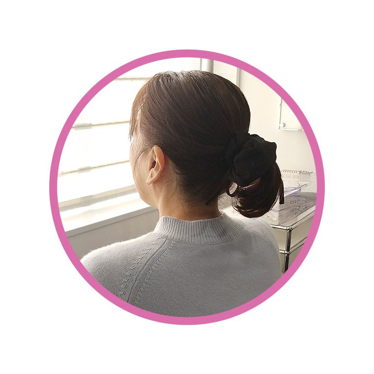 Q子（混合肌／50代） 