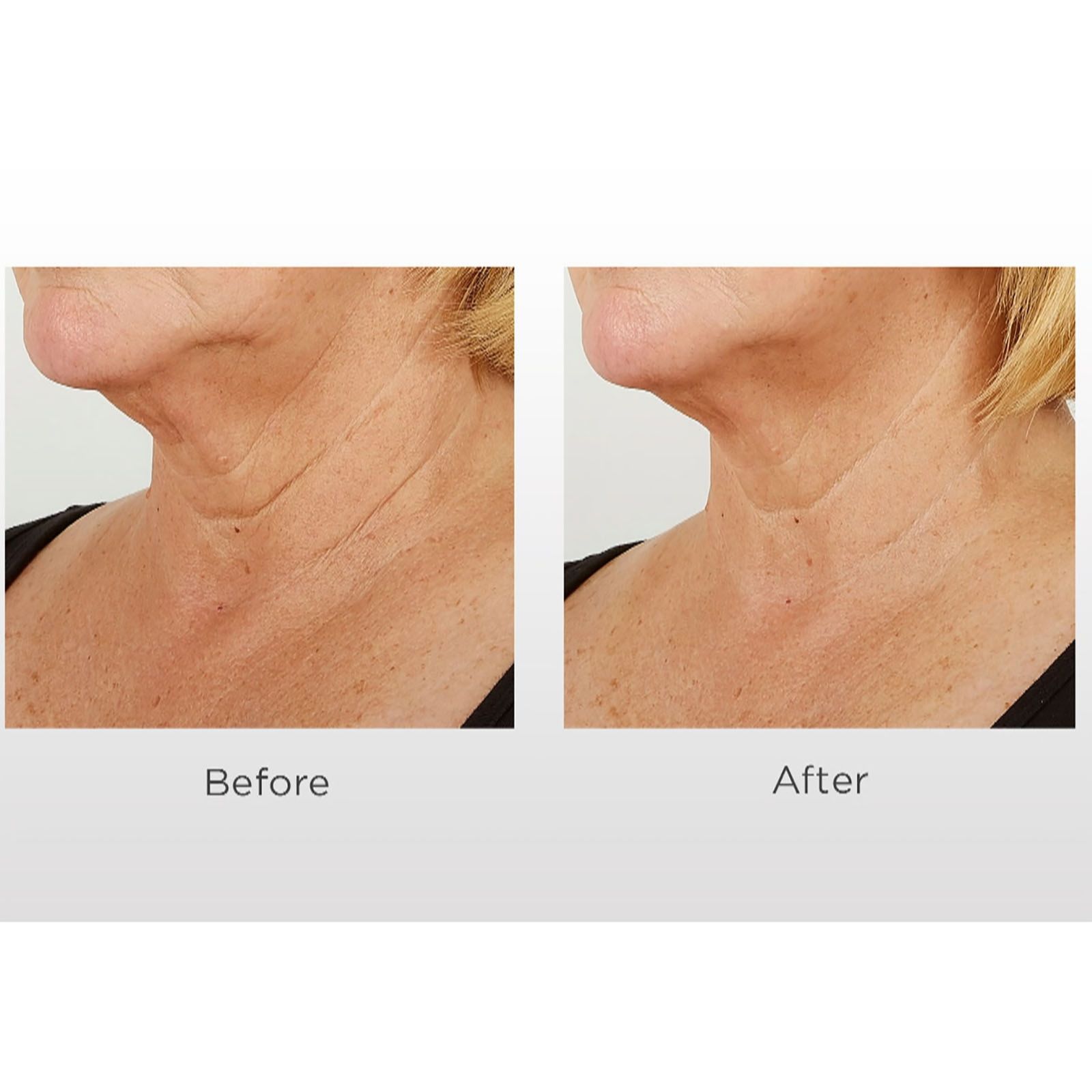 qvc prai neck cream